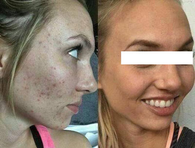 before and after selfie