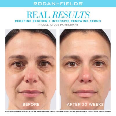 R+F real results before and after