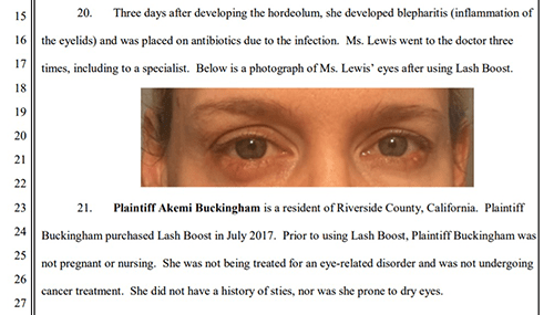 Rodan and Fields lawsuit